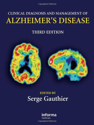 clinical diagnosis and management of alzheimer"s disease