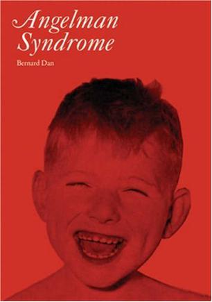 angelman syndrome