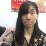 芳