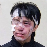 朱小手