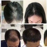 姚希燕养发