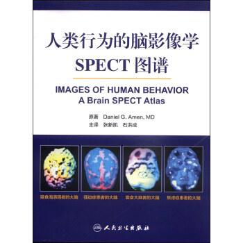 人类行为的脑影像学：SPECT图
